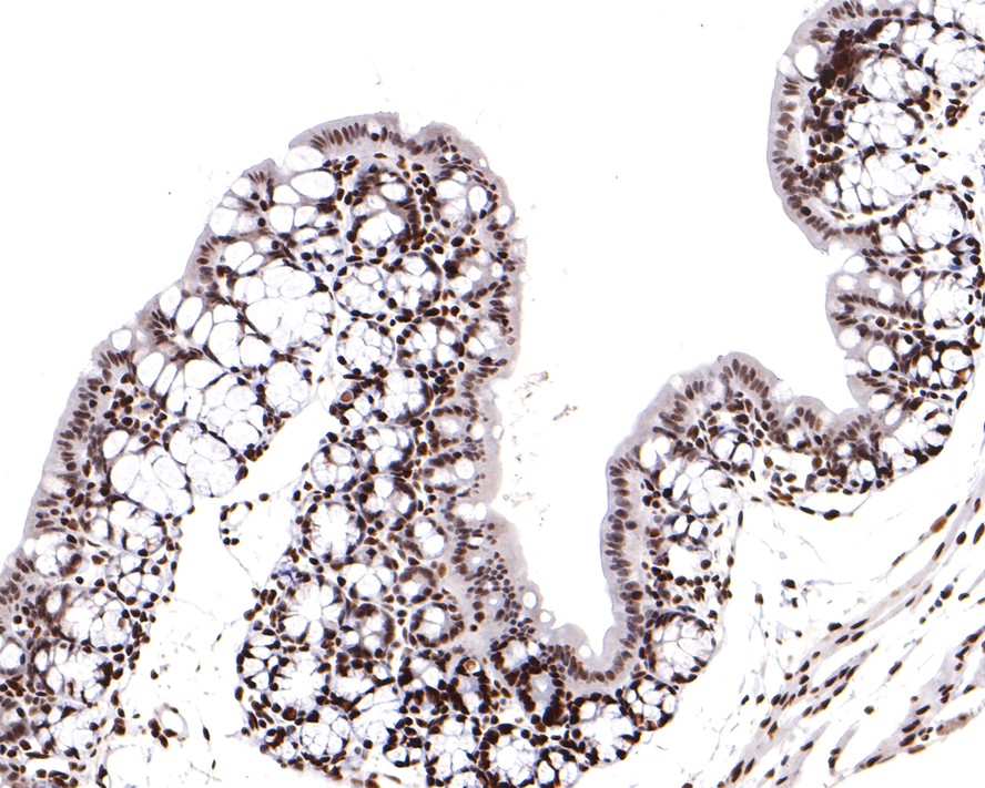 Immunohistochemical analysis of paraffin-embedded mouse large intestine tissue with Rabbit anti-Sumo 2+3 antibody (ET1701-17) at 1/400 dilution.<br />
<br />
The section was pre-treated using heat mediated antigen retrieval with sodium citrate buffer (pH 6.0) for 2 minutes. The tissues were blocked in 1% BSA for 20 minutes at room temperature, washed with ddH2O and PBS, and then probed with the primary antibody (ET1701-17) at 1/400 dilution for 1 hour at room temperature. The detection was performed using an HRP conjugated compact polymer system. DAB was used as the chromogen. Tissues were counterstained with hematoxylin and mounted with DPX.