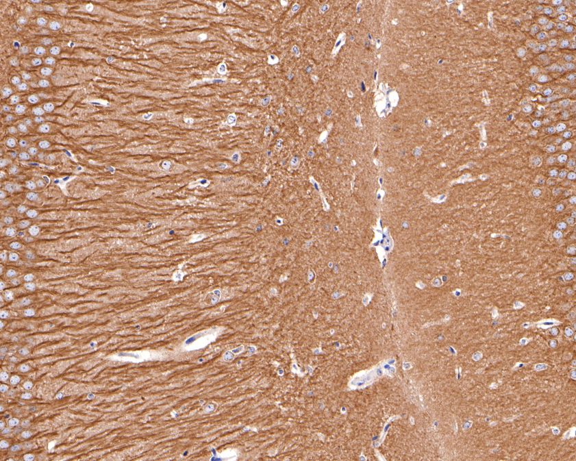Immunohistochemical analysis of paraffin-embedded mouse hippocampus tissue using anti-THY1 antibody. The section was pre-treated using heat mediated antigen retrieval with Tris-EDTA buffer (pH 9.0) for 20 minutes.The tissues were blocked in 1% BSA for 30 minutes at room temperature, washed with ddH2O and PBS, and then probed with the primary antibody (ET1702-92, 1/400) for 30 minutes at room temperature. The detection was performed using an HRP conjugated compact polymer system. DAB was used as the chromogen. Tissues were counterstained with hematoxylin and mounted with DPX.