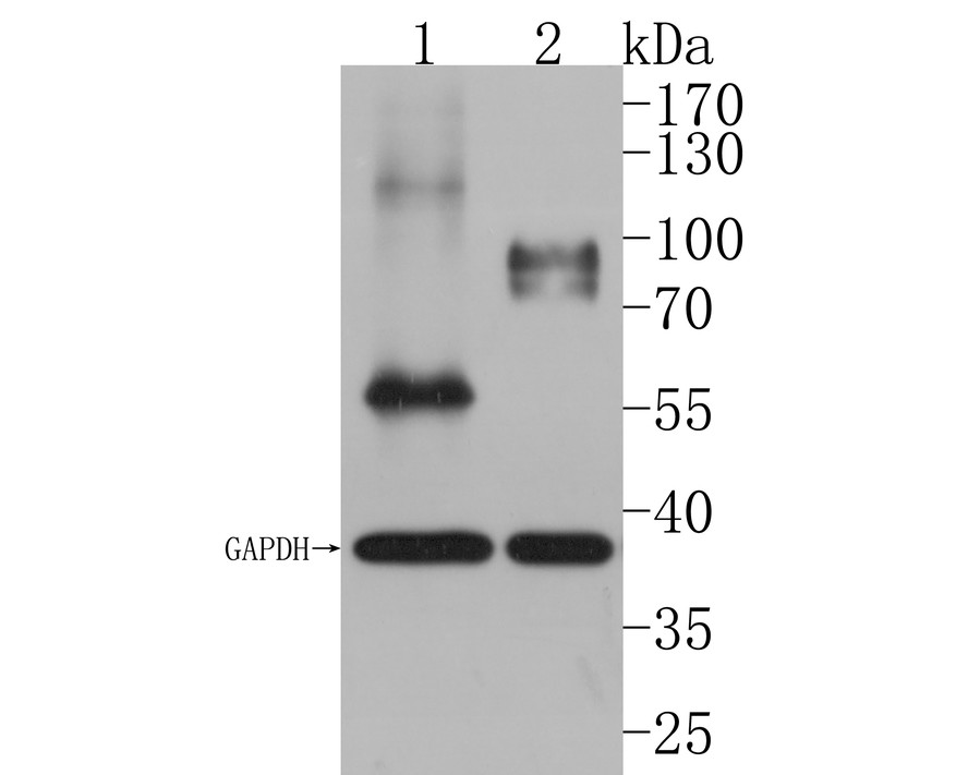 Western blot analysis of ChT1 on different lysates with Rabbit anti-ChT1 antibody (HA500314) at 1/1,000 dilution.<br />
<br />
Lane 1: Mouse stomach tissue lysate<br />
Lane 2: Human stomach tissue lysate<br />
<br />
Lysates/proteins at 20 µg/Lane.<br />
<br />
Predicted band size: 42 kDa<br />
Observed band size: 55/90 kDa<br />
<br />
Exposure time: 1 minute;<br />
<br />
10% SDS-PAGE gel.<br />
<br />
Proteins were transferred to a PVDF membrane and blocked with 5% NFDM/TBST for 1 hour at room temperature. The primary antibody (HA500314) at 1/1,000 dilution was used in 5% NFDM/TBST at room temperature for 2 hours. Goat Anti-Rabbit IgG - HRP Secondary Antibody (HA1001) at 1:200,000 dilution was used for 1 hour at room temperature.