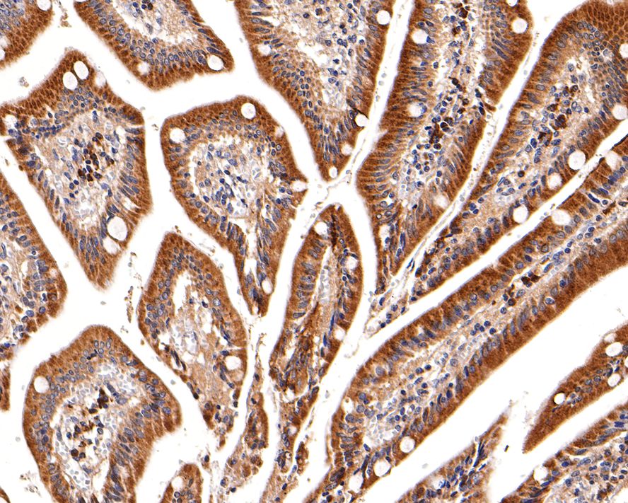 Immunohistochemical analysis of paraffin-embedded human small intestine tissue with Rabbit anti-ChT1 antibody (HA500314) at 1/600 dilution.<br />
<br />
The section was pre-treated using heat mediated antigen retrieval with Tris-EDTA buffer (pH 9.0) for 20 minutes. The tissues were blocked in 1% BSA for 20 minutes at room temperature, washed with ddH2O and PBS, and then probed with the primary antibody (HA500314) at 1/600 dilution for 1 hour at room temperature. The detection was performed using an HRP conjugated compact polymer system. DAB was used as the chromogen. Tissues were counterstained with hematoxylin and mounted with DPX.