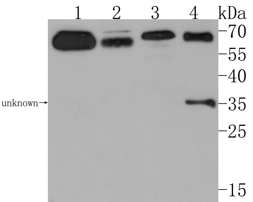 Western blot analysis of CNTFR on different lysates with Rabbit anti-CNTFR antibody (HA500319) at 1/1,000 dilution.<br />
<br />
Lane 1: Mouse brain tissue lysate<br />
Lane 2: Mouse cerebellum tissue lysate<br />
Lane 3: Human skeletal muscle tissue lysate<br />
Lane 4: Rat skeletal muscle  tissue lysate<br />
<br />
Lysates/proteins at 20 µg/Lane.<br />
<br />
Predicted band size: 41 kDa<br />
Observed band size: 70/65/35 kDa<br />
<br />
Exposure time: 2 minutes;<br />
<br />
12% SDS-PAGE gel.<br />
<br />
Proteins were transferred to a PVDF membrane and blocked with 5% NFDM/TBST for 1 hour at room temperature. The primary antibody (HA500319) at 1/1,000 dilution was used in 5% NFDM/TBST at room temperature for 2 hours. Goat Anti-Rabbit IgG - HRP Secondary Antibody (HA1001) at 1:200,000 dilution was used for 1 hour at room temperature.