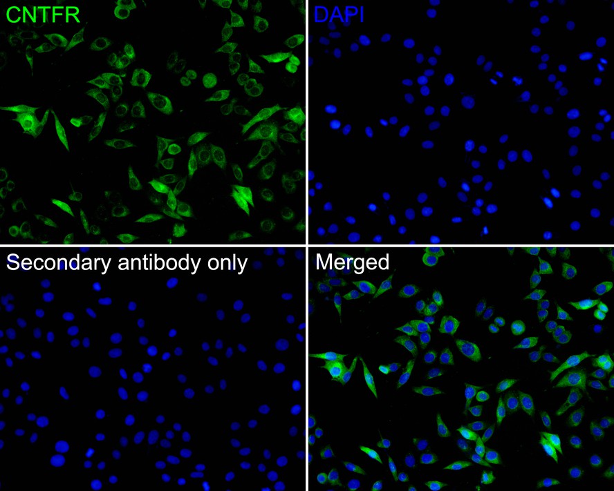 Immunocytochemistry analysis of SH-SY5Y cells labeling CNTFR with Rabbit anti-CNTFR antibody (HA500319) at 1/200 dilution.<br />
<br />
Cells were fixed in 4% paraformaldehyde for 10 minutes at 37 ℃, and then blocked with 2% negative goat serum for 30 minutes at room temperature. Cells were then incubated with Rabbit anti-CNTFR antibody (HA500319) at 1/200 dilution in 2% negative goat serum overnight at 4 ℃. Goat Anti-Rabbit IgG H&L (iFluor™ 488, HA1121) was used as the secondary antibody at 1/1,000 dilution. PBS instead of the primary antibody was used as the secondary antibody only control. Nuclear DNA was labelled in blue with DAPI.