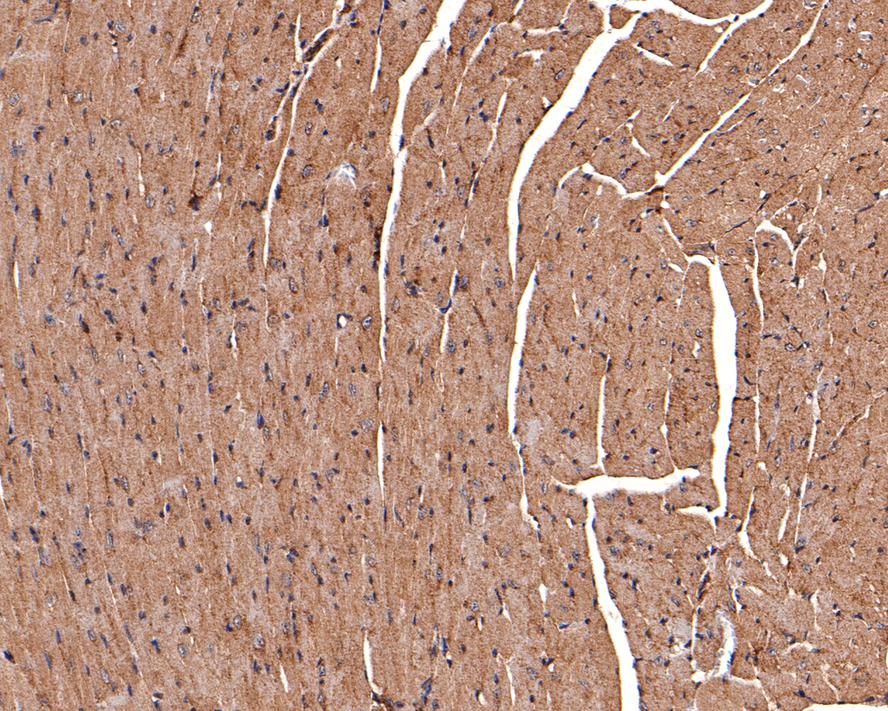 Immunohistochemical analysis of paraffin-embedded mouse heart tissue with Rabbit anti-CNTFR antibody (HA500319) at 1/200 dilution.<br />
<br />
The section was pre-treated using heat mediated antigen retrieval with Tris-EDTA buffer (pH 9.0) for 20 minutes. The tissues were blocked in 1% BSA for 20 minutes at room temperature, washed with ddH2O and PBS, and then probed with the primary antibody (HA500319) at 1/200 dilution for 1 hour at room temperature. The detection was performed using an HRP conjugated compact polymer system. DAB was used as the chromogen. Tissues were counterstained with hematoxylin and mounted with DPX.