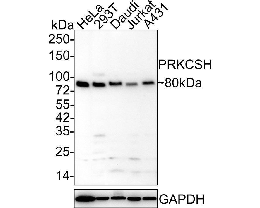 Western blot analysis of Glucosidase 2 subunit beta on different lysates with Mouse anti-Glucosidase 2 subunit beta antibody (HA600054) at 1/1,000 dilution.<br />
<br />
Lane 1: HeLa cell lysate<br />
Lane 2: 293T cell lysate<br />
Lane 3: Daudi cell lysate<br />
Lane 4: Jurkat cell lysate<br />
Lane 5: A431 cell lysate<br />
<br />
Lysates/proteins at 20 µg/Lane.<br />
<br />
Predicted band size: 59 kDa<br />
Observed band size: 80 kDa<br />
<br />
Exposure time: 5 minutes;<br />
<br />
4-20% SDS-PAGE gel.<br />
<br />
Proteins were transferred to a PVDF membrane and blocked with 5% NFDM/TBST for 1 hour at room temperature. The primary antibody (HA600054) at 1/1,000 dilution was used in 5% NFDM/TBST at 4℃ overnight. Goat Anti-Mouse IgG - HRP Secondary Antibody (HA1006) at 1/50,000 dilution was used for 1 hour at room temperature.