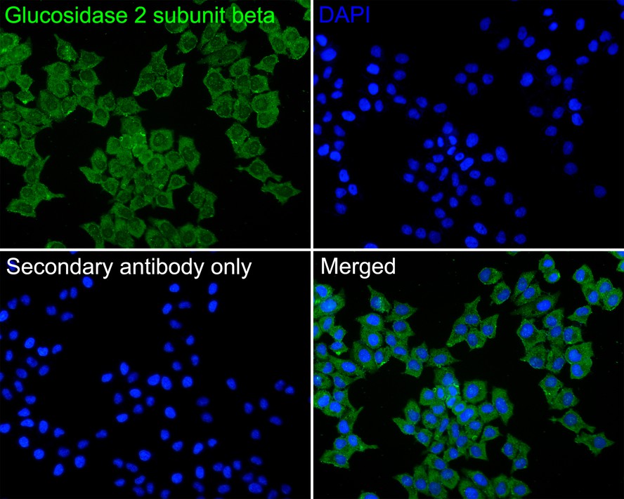 Immunocytochemistry analysis of Hela cells labeling Glucosidase 2 subunit beta with Mouse anti-Glucosidase 2 subunit beta antibody (HA600054) at 1/100 dilution.<br />
<br />
Cells were fixed in 4% paraformaldehyde for 15 minutes, permeabilized with 0.1% Triton X-100 in PBS for 15 minutes, and then blocked with 1% BSA for 30 minutes at room temperature. Cells were then incubated with Mouse anti-Glucosidase 2 subunit beta antibody (HA600054) at 1/100 dilution in 1% BSA overnight at 4 ℃. Goat Anti-Mouse IgG H&L (iFluor™ 488, HA1125) was used as the secondary antibody at 1/1,000 dilution. PBS instead of the primary antibody was used as the secondary antibody only control. Nuclear DNA was labelled in blue with DAPI.