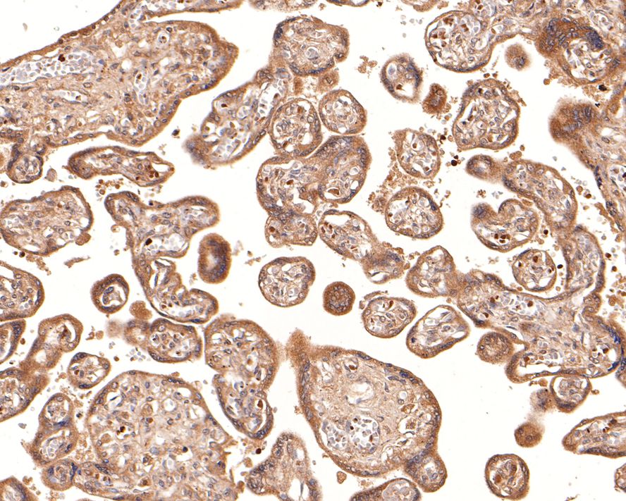 Immunohistochemical analysis of paraffin-embedded human placenta tissue with Mouse anti-Glucosidase 2 subunit beta antibody (HA600054) at 1/200 dilution.<br />
<br />
The section was pre-treated using heat mediated antigen retrieval with Tris-EDTA buffer (pH 9.0) for 20 minutes. The tissues were blocked in 1% BSA for 20 minutes at room temperature, washed with ddH2O and PBS, and then probed with the primary antibody (HA600054) at 1/200 dilution for 1 hour at room temperature. The detection was performed using an HRP conjugated compact polymer system. DAB was used as the chromogen. Tissues were counterstained with hematoxylin and mounted with DPX.