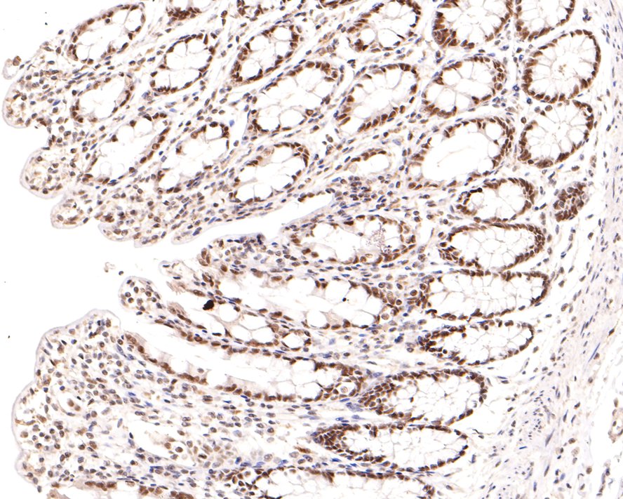 Immunohistochemical analysis of paraffin-embedded rat kidney tissue with Mouse anti-Nuclear Receptor Corepressor antibody (HA600055) at 1/600 dilution.<br />
<br />
The section was pre-treated using heat mediated antigen retrieval with sodium citrate buffer (pH 6.0) for 2 minutes. The tissues were blocked in 1% BSA for 20 minutes at room temperature, washed with ddH2O and PBS, and then probed with the primary antibody (HA600055) at 1/600 dilution for 1 hour at room temperature. The detection was performed using an HRP conjugated compact polymer system. DAB was used as the chromogen. Tissues were counterstained with hematoxylin and mounted with DPX.