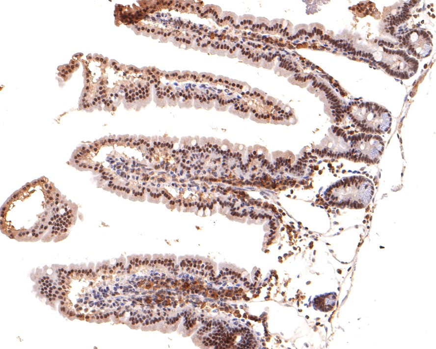 Immunohistochemical analysis of paraffin-embedded human kidney tissue with Mouse anti-Nuclear Receptor Corepressor antibody (HA600055) at 1/600 dilution.<br />
<br />
The section was pre-treated using heat mediated antigen retrieval with sodium citrate buffer (pH 6.0) for 2 minutes. The tissues were blocked in 1% BSA for 20 minutes at room temperature, washed with ddH2O and PBS, and then probed with the primary antibody (HA600055) at 1/600 dilution for 1 hour at room temperature. The detection was performed using an HRP conjugated compact polymer system. DAB was used as the chromogen. Tissues were counterstained with hematoxylin and mounted with DPX.