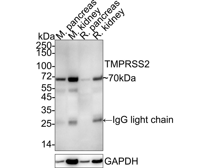 Western blot analysis of TMPRSS2 on Hela cell lysates with Mouse anti-TMPRSS2 antibody (HA600057) at 1/500 dilution.<br />
<br />
Lysates/proteins at 10 µg/Lane.<br />
<br />
Predicted band size: 54 kDa<br />
Observed band size: 50 kDa<br />
<br />
Exposure time: 1 minute;<br />
<br />
12% SDS-PAGE gel.<br />
<br />
Proteins were transferred to a PVDF membrane and blocked with 5% NFDM/TBST for 1 hour at room temperature. The primary antibody (HA600057) at 1/500 dilution was used in 5% NFDM/TBST at room temperature for 2 hours. Goat Anti-Mouse IgG - HRP Secondary Antibody (HA1006) at 1:20,000 dilution was used for 1 hour at room temperature.