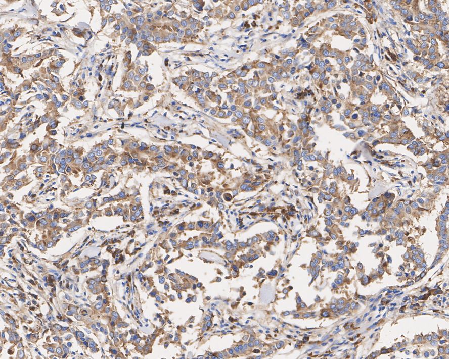 Immunohistochemical analysis of paraffin-embedded human pancreas tissue with Mouse anti-RPS6 antibody (HA600084) at 1/800 dilution.<br />
<br />
The section was pre-treated using heat mediated antigen retrieval with sodium citrate buffer (pH 6.0) for 2 minutes. The tissues were blocked in 1% BSA for 20 minutes at room temperature, washed with ddH2O and PBS, and then probed with the primary antibody (HA600084) at 1/800 dilution for 1 hour at room temperature. The detection was performed using an HRP conjugated compact polymer system. DAB was used as the chromogen. Tissues were counterstained with hematoxylin and mounted with DPX.