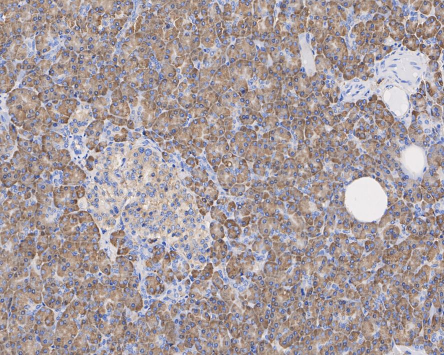 Immunohistochemical analysis of paraffin-embedded mouse brain tissue with Mouse anti-RPS6 antibody (HA600084) at 1/1,500 dilution.<br />
<br />
The section was pre-treated using heat mediated antigen retrieval with sodium citrate buffer (pH 6.0) for 2 minutes. The tissues were blocked in 1% BSA for 20 minutes at room temperature, washed with ddH2O and PBS, and then probed with the primary antibody (HA600084) at 1/1,500 dilution for 1 hour at room temperature. The detection was performed using an HRP conjugated compact polymer system. DAB was used as the chromogen. Tissues were counterstained with hematoxylin and mounted with DPX.