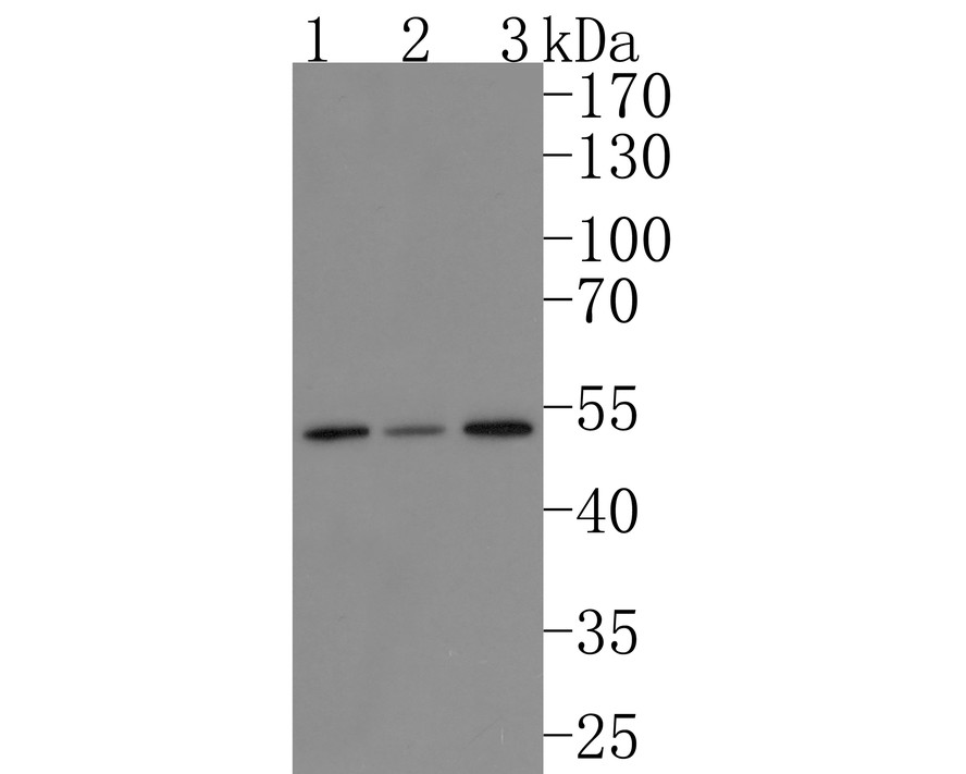 Western blot analysis of AMSH on different lysates with Rabbit anti-AMSH antibody (HA720085) at 1/500 dilution.<br />
<br />
Lane 1: HepG2 cell lysate<br />
Lane 2: Hela cell lysate<br />
Lane 3: SW480 cell lysate<br />
<br />
Lysates/proteins at 10 µg/Lane.<br />
<br />
Predicted band size: 48 kDa<br />
Observed band size: 50kDa<br />
<br />
Exposure time: 2 minutes;<br />
<br />
10% SDS-PAGE gel.<br />
<br />
Proteins were transferred to a PVDF membrane and blocked with 5% NFDM/TBST for 1 hour at room temperature. The primary antibody (HA720085) at 1/500 dilution was used in 5% NFDM/TBST at room temperature for 2 hours. Goat Anti-Rabbit IgG - HRP Secondary Antibody (HA1001) at 1:200,000 dilution was used for 1 hour at room temperature.