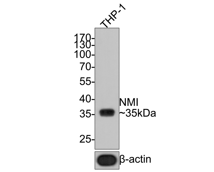 Western blot analysis of NMI on THP-1 cell lysates with Rabbit anti-NMI antibody (HA720087) at 1/1,000 dilution.<br />
<br />
Lysates/proteins at 10 µg/Lane.<br />
<br />
Predicted band size: 35 kDa<br />
Observed band size: 35 kDa<br />
<br />
Exposure time: 1 minute;<br />
<br />
10% SDS-PAGE gel.<br />
<br />
Proteins were transferred to a PVDF membrane and blocked with 5% NFDM/TBST for 1 hour at room temperature. The primary antibody (HA720087) at 1/1,000 dilution was used in 5% NFDM/TBST at room temperature for 2 hours. Goat Anti-Rabbit IgG - HRP Secondary Antibody (HA1001) at 1:200,000 dilution was used for 1 hour at room temperature.