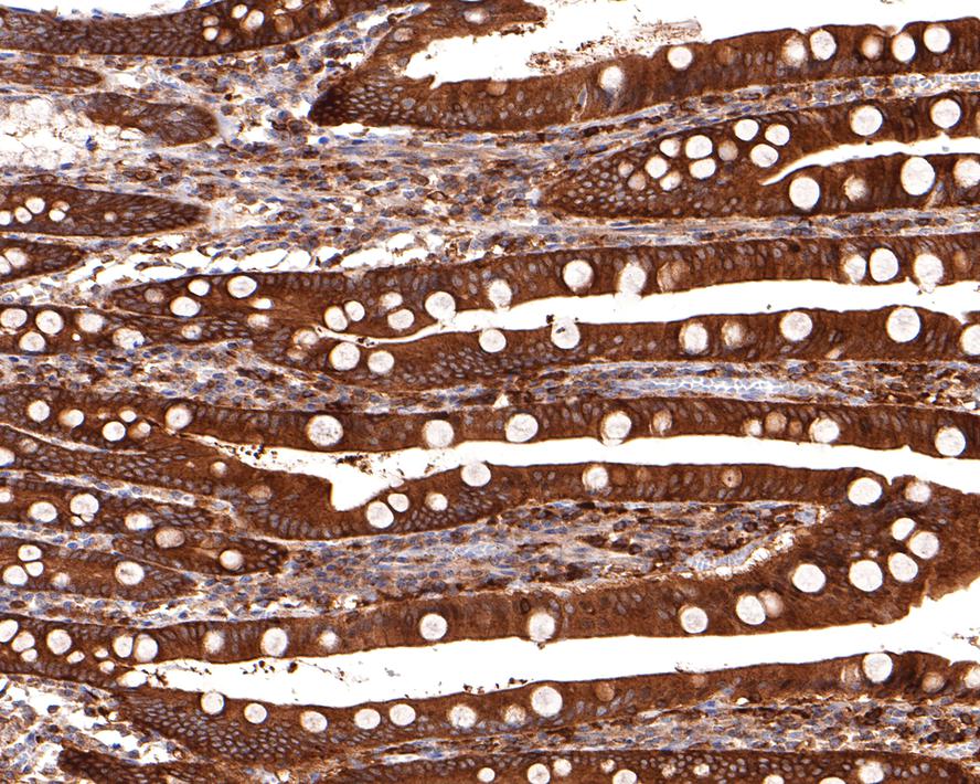 Immunohistochemical analysis of paraffin-embedded human small intestine tissue with Rabbit anti-NMI antibody (HA720087) at 1/400 dilution.<br />
<br />
The section was pre-treated using heat mediated antigen retrieval with sodium citrate buffer (pH 6.0) for 2 minutes. The tissues were blocked in 1% BSA for 20 minutes at room temperature, washed with ddH2O and PBS, and then probed with the primary antibody (HA720087) at 1/400 dilution for 1 hour at room temperature. The detection was performed using an HRP conjugated compact polymer system. DAB was used as the chromogen. Tissues were counterstained with hematoxylin and mounted with DPX.