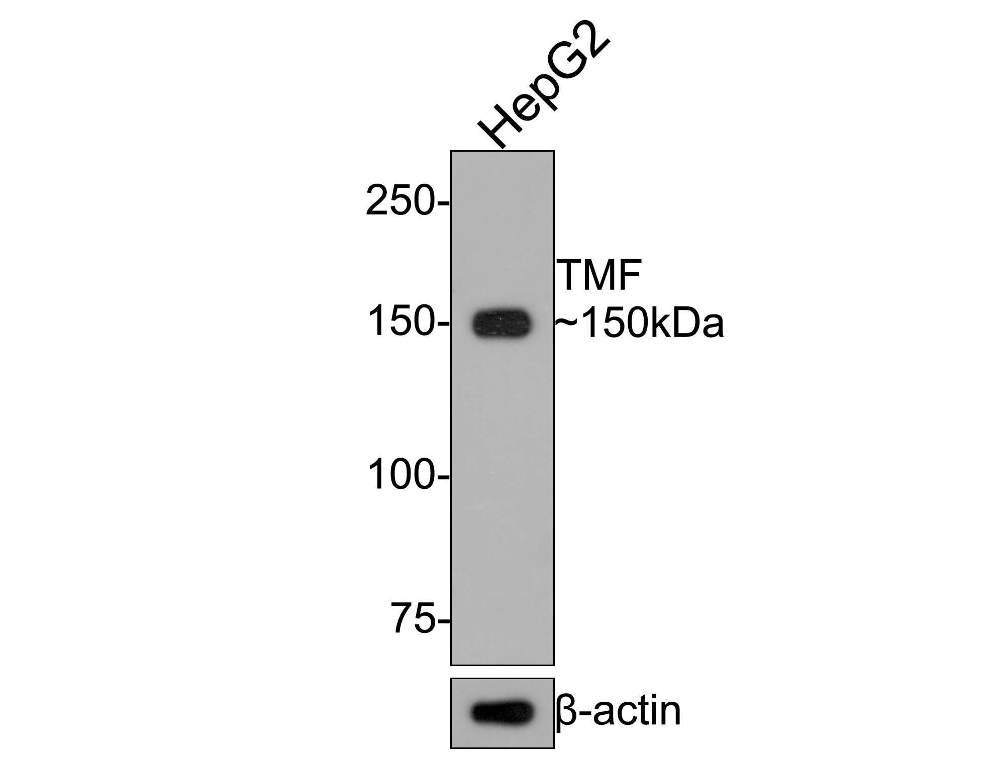 Western blot analysis of TMF on HepG2 cell lysates with Rabbit anti-TMF antibody (HA720089) at 1/1,000 dilution.<br />
<br />
Lysates/proteins at 10 µg/Lane.<br />
<br />
Predicted band size: 123 kDa<br />
Observed band size: 150 kDa<br />
<br />
Exposure time: 2 minutes;<br />
<br />
6% SDS-PAGE gel.<br />
<br />
Proteins were transferred to a PVDF membrane and blocked with 5% NFDM/TBST for 1 hour at room temperature. The primary antibody (HA720089) at 1/1,000 dilution was used in 5% NFDM/TBST at room temperature for 2 hours. Goat Anti-Rabbit IgG - HRP Secondary Antibody (HA1001) at 1:200,000 dilution was used for 1 hour at room temperature.