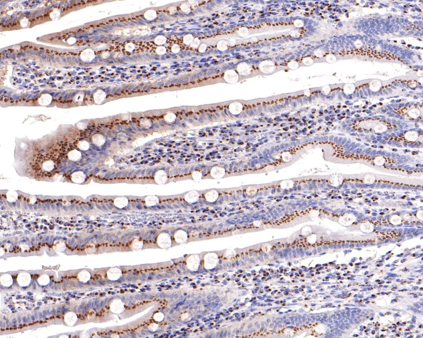 Immunohistochemical analysis of paraffin-embedded human small intestine tissue with Rabbit anti-TMF antibody (HA720089) at 1/400 dilution.<br />
<br />
The section was pre-treated using heat mediated antigen retrieval with sodium citrate buffer (pH 6.0) for 2 minutes. The tissues were blocked in 1% BSA for 20 minutes at room temperature, washed with ddH2O and PBS, and then probed with the primary antibody (HA720089) at 1/400 dilution for 1 hour at room temperature. The detection was performed using an HRP conjugated compact polymer system. DAB was used as the chromogen. Tissues were counterstained with hematoxylin and mounted with DPX.