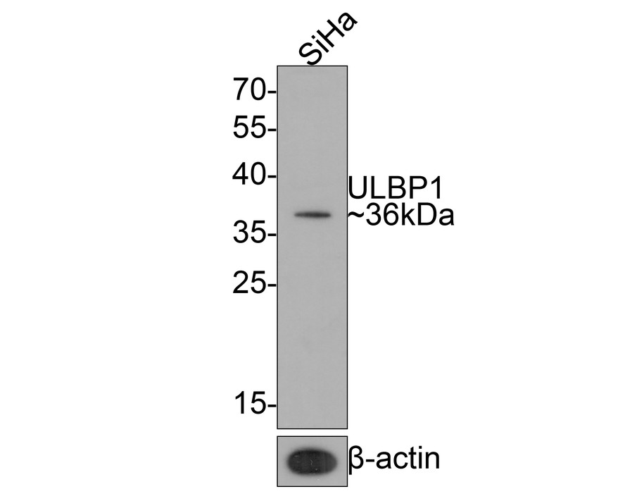 Western blot analysis of ULBP1 on SiHa cell lysates with Rabbit anti-ULBP1 antibody (HA720092) at 1/500 dilution.<br />
<br />
Lysates/proteins at 10 µg/Lane.<br />
<br />
Predicted band size: 28 kDa<br />
Observed band size: 36 kDa<br />
<br />
Exposure time: 2 minutes;<br />
<br />
12% SDS-PAGE gel.<br />
<br />
Proteins were transferred to a PVDF membrane and blocked with 5% NFDM/TBST for 1 hour at room temperature. The primary antibody (HA720092) at 1/500 dilution was used in 5% NFDM/TBST at room temperature for 2 hours. Goat Anti-Rabbit IgG - HRP Secondary Antibody (HA1001) at 1:200,000 dilution was used for 1 hour at room temperature.
