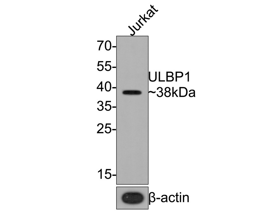 Western blot analysis of ULBP1 on Jurkat cell lysates with Rabbit anti-ULBP1 antibody (HA720092) at 1/1,000 dilution.<br />
<br />
Lysates/proteins at 10 µg/Lane.<br />
<br />
Predicted band size: 28 kDa<br />
Observed band size: 38 kDa<br />
<br />
Exposure time: 2 minutes;<br />
<br />
12% SDS-PAGE gel.<br />
<br />
Proteins were transferred to a PVDF membrane and blocked with 5% NFDM/TBST for 1 hour at room temperature. The primary antibody (HA720092) at 1/1,000 dilution was used in 5% NFDM/TBST at room temperature for 2 hours. Goat Anti-Rabbit IgG - HRP Secondary Antibody (HA1001) at 1:200,000 dilution was used for 1 hour at room temperature.