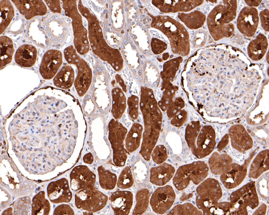 Immunohistochemical analysis of paraffin-embedded human kidney tissue with Rabbit anti-BIN1 antibody (HA721001) at 1/400 dilution.<br />
<br />
The section was pre-treated using heat mediated antigen retrieval with sodium citrate buffer (pH 6.0) for 2 minutes. The tissues were blocked in 1% BSA for 20 minutes at room temperature, washed with ddH2O and PBS, and then probed with the primary antibody (HA721001) at 1/400 dilution for 1 hour at room temperature. The detection was performed using an HRP conjugated compact polymer system. DAB was used as the chromogen. Tissues were counterstained with hematoxylin and mounted with DPX.