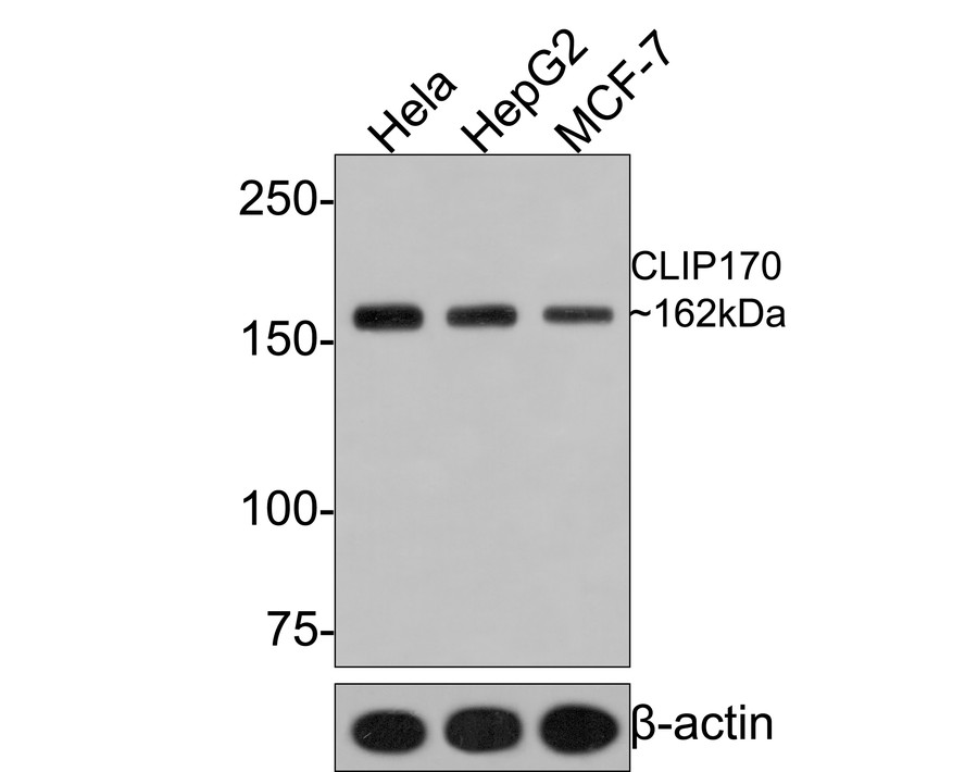 Western blot analysis of CLIP170 on different lysates with Rabbit anti-CLIP170 antibody (HA721004) at 1/500 dilution.<br />
<br />
Lane 1: Hela cell lysate<br />
Lane 2: HepG2 cell lysate<br />
Lane 3: MCF-7 cell lysate<br />
<br />
Lysates/proteins at 10 µg/Lane.<br />
<br />
Predicted band size: 162 kDa<br />
Observed band size: 162 kDa<br />
<br />
Exposure time: 1 minute;<br />
<br />
6% SDS-PAGE gel.<br />
<br />
Proteins were transferred to a PVDF membrane and blocked with 5% NFDM/TBST for 1 hour at room temperature. The primary antibody (HA721004) at 1/500 dilution was used in 5% NFDM/TBST at room temperature for 2 hours. Goat Anti-Rabbit IgG - HRP Secondary Antibody (HA1001) at 1:200,000 dilution was used for 1 hour at room temperature.