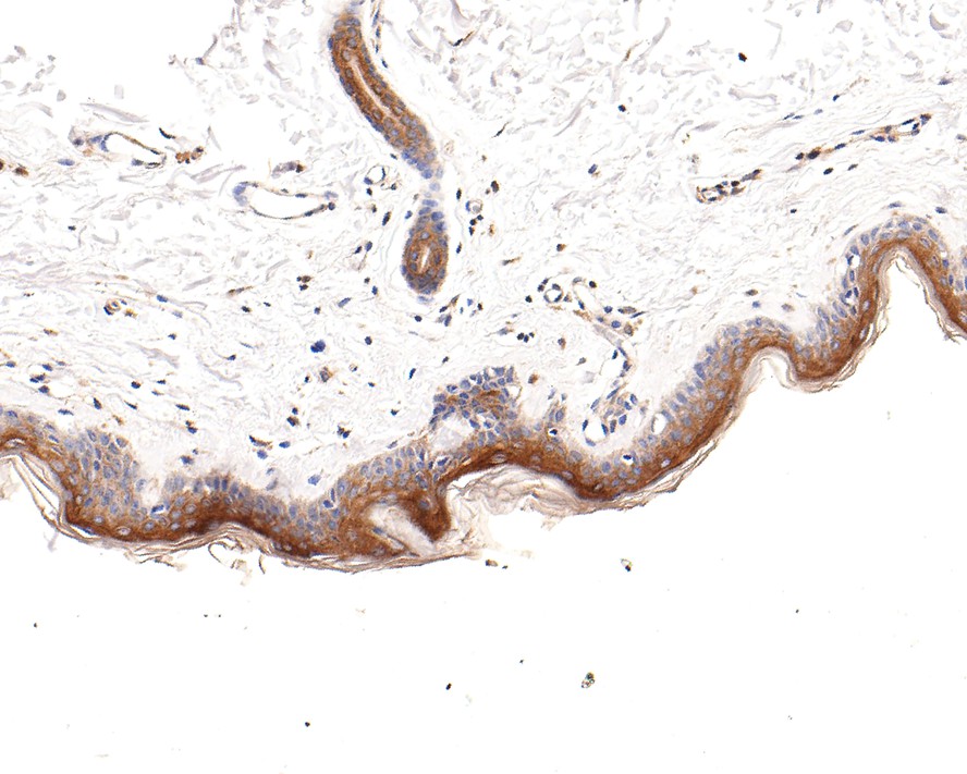 Immunohistochemical analysis of paraffin-embedded human skin tissue with Rabbit anti-CLIP170 antibody (HA721004) at 1/100 dilution.<br />
<br />
The section was pre-treated using heat mediated antigen retrieval with Tris-EDTA buffer (pH 9.0) for 20 minutes. The tissues were blocked in 1% BSA for 20 minutes at room temperature, washed with ddH2O and PBS, and then probed with the primary antibody (HA721004) at 1/100 dilution for 1 hour at room temperature. The detection was performed using an HRP conjugated compact polymer system. DAB was used as the chromogen. Tissues were counterstained with hematoxylin and mounted with DPX.