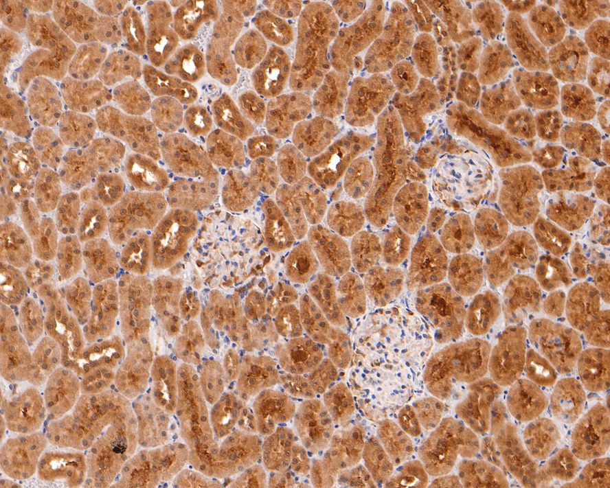 Immunohistochemical analysis of paraffin-embedded rat kidney tissue with Rabbit anti-Ube2L3 antibody (HA721005) at 1/400 dilution.<br />
<br />
The section was pre-treated using heat mediated antigen retrieval with sodium citrate buffer (pH 6.0) for 2 minutes. The tissues were blocked in 1% BSA for 20 minutes at room temperature, washed with ddH2O and PBS, and then probed with the primary antibody (HA721005) at 1/400 dilution for 1 hour at room temperature. The detection was performed using an HRP conjugated compact polymer system. DAB was used as the chromogen. Tissues were counterstained with hematoxylin and mounted with DPX.