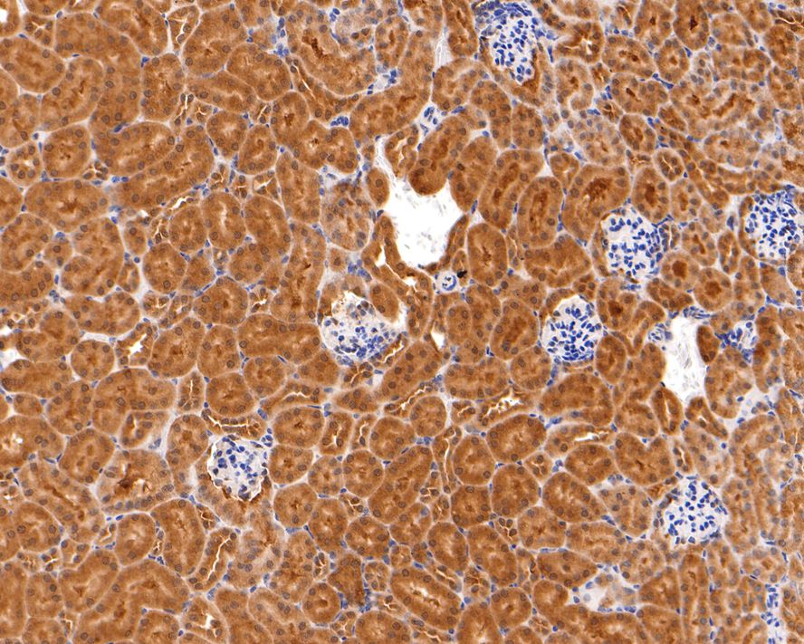 Immunohistochemical analysis of paraffin-embedded mouse kidney tissue with Rabbit anti-Ube2L3 antibody (HA721005) at 1/400 dilution.<br />
<br />
The section was pre-treated using heat mediated antigen retrieval with sodium citrate buffer (pH 6.0) for 2 minutes. The tissues were blocked in 1% BSA for 20 minutes at room temperature, washed with ddH2O and PBS, and then probed with the primary antibody (HA721005) at 1/400 dilution for 1 hour at room temperature. The detection was performed using an HRP conjugated compact polymer system. DAB was used as the chromogen. Tissues were counterstained with hematoxylin and mounted with DPX.