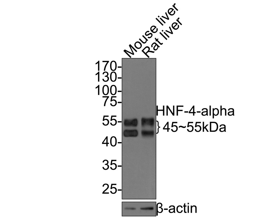Western blot analysis of HNF-4-alpha on different lysates with Rabbit anti-HNF-4-alpha antibody (HA721006) at 1/500 dilution.<br />
<br />
Lane 1: Mouse liver tissue lysate<br />
Lane 2: Rat liver tissue lysate<br />
<br />
Lysates/proteins at 20 µg/Lane.<br />
<br />
Predicted band size: 53 kDa<br />
Observed band size: 45~55 kDa<br />
<br />
Exposure time: 2 minutes;<br />
<br />
10% SDS-PAGE gel.<br />
<br />
Proteins were transferred to a PVDF membrane and blocked with 5% NFDM/TBST for 1 hour at room temperature. The primary antibody (HA721006) at 1/500 dilution was used in 5% NFDM/TBST at room temperature for 2 hours. Goat Anti-Rabbit IgG - HRP Secondary Antibody (HA1001) at 1:200,000 dilution was used for 1 hour at room temperature.