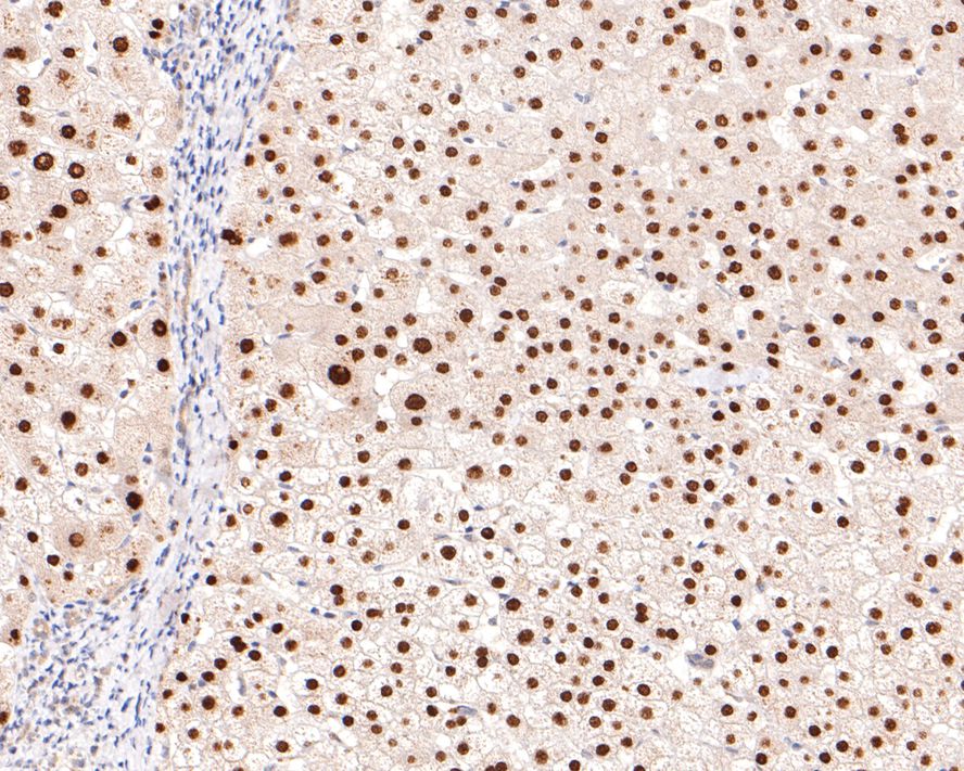 Immunohistochemical analysis of paraffin-embedded human liver tissue with Rabbit anti-HNF-4-alpha antibody (HA721006) at 1/400 dilution.<br />
<br />
The section was pre-treated using heat mediated antigen retrieval with sodium citrate buffer (pH 6.0) for 2 minutes. The tissues were blocked in 1% BSA for 20 minutes at room temperature, washed with ddH2O and PBS, and then probed with the primary antibody (HA721006) at 1/400 dilution for 1 hour at room temperature. The detection was performed using an HRP conjugated compact polymer system. DAB was used as the chromogen. Tissues were counterstained with hematoxylin and mounted with DPX.