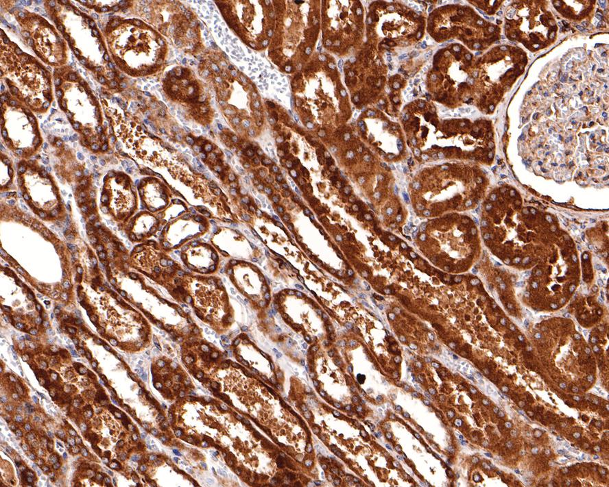 Immunohistochemical analysis of paraffin-embedded human kidney tissue with Rabbit anti-RAB5C antibody (HA721012) at 1/400 dilution.<br />
<br />
The section was pre-treated using heat mediated antigen retrieval with Tris-EDTA buffer (pH 9.0) for 20 minutes. The tissues were blocked in 1% BSA for 20 minutes at room temperature, washed with ddH2O and PBS, and then probed with the primary antibody (HA721012) at 1/400 dilution for 1 hour at room temperature. The detection was performed using an HRP conjugated compact polymer system. DAB was used as the chromogen. Tissues were counterstained with hematoxylin and mounted with DPX.