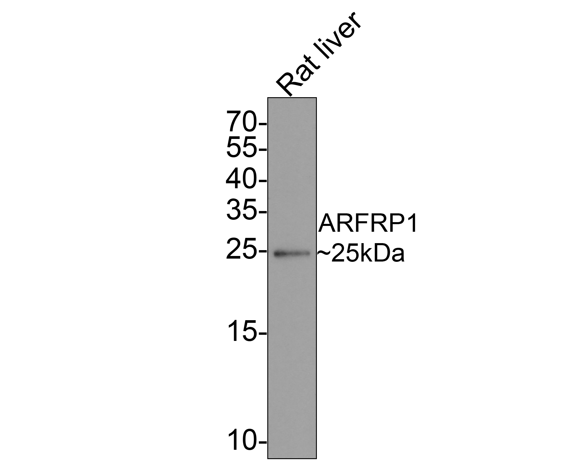Western blot analysis of ARFRP1 on rat liver tissue lysates with Rabbit anti-ARFRP1 antibody (HA721020) at 1/500 dilution.<br />
<br />
Lysates/proteins at 20 µg/Lane.<br />
<br />
Predicted band size: 23 kDa<br />
Observed band size: 25 kDa<br />
<br />
Exposure time: 2 minutes;<br />
<br />
15% SDS-PAGE gel.<br />
<br />
Proteins were transferred to a PVDF membrane and blocked with 5% NFDM/TBST for 1 hour at room temperature. The primary antibody (HA721020) at 1/500 dilution was used in 5% NFDM/TBST at room temperature for 2 hours. Goat Anti-Rabbit IgG - HRP Secondary Antibody (HA1001) at 1:200,000 dilution was used for 1 hour at room temperature.