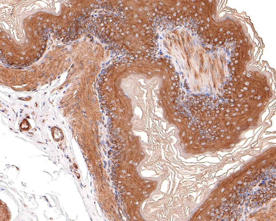 Immunohistochemical analysis of paraffin-embedded rat esophagus tissue with Rabbit anti-CYFIP1 antibody (HA721095) at 1/100 dilution.<br />
<br />
The section was pre-treated using heat mediated antigen retrieval with Tris-EDTA buffer (pH 9.0) for 20 minutes. The tissues were blocked in 1% BSA for 20 minutes at room temperature, washed with ddH2O and PBS, and then probed with the primary antibody (HA721095) at 1/100 dilution for 1 hour at room temperature. The detection was performed using an HRP conjugated compact polymer system. DAB was used as the chromogen. Tissues were counterstained with hematoxylin and mounted with DPX.