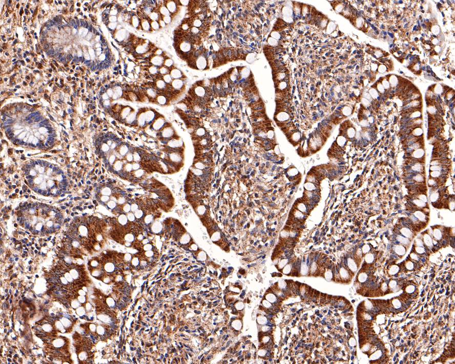 Immunohistochemical analysis of paraffin-embedded human small intestine tissue with Rabbit anti-MST4 antibody (HA721094) at 1/1,000 dilution.<br />
<br />
The section was pre-treated using heat mediated antigen retrieval with Tris-EDTA buffer (pH 9.0) for 20 minutes. The tissues were blocked in 1% BSA for 20 minutes at room temperature, washed with ddH2O and PBS, and then probed with the primary antibody (HA721094) at 1/1,000 dilution for 1 hour at room temperature. The detection was performed using an HRP conjugated compact polymer system. DAB was used as the chromogen. Tissues were counterstained with hematoxylin and mounted with DPX.