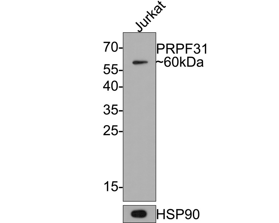 Western blot analysis of PRPF31 on Jurkat cell lysates with Rabbit anti-PRPF31 antibody (HA721089) at 1/500 dilution.<br />
<br />
Lysates/proteins at 10 µg/Lane.<br />
<br />
Predicted band size: 55 kDa<br />
Observed band size: 60 kDa<br />
<br />
Exposure time: 2 minutes;<br />
<br />
12% SDS-PAGE gel.<br />
<br />
Proteins were transferred to a PVDF membrane and blocked with 5% NFDM/TBST for 1 hour at room temperature. The primary antibody (HA721089) at 1/500 dilution was used in 5% NFDM/TBST at room temperature for 2 hours. Goat Anti-Rabbit IgG - HRP Secondary Antibody (HA1001) at 1:300,000 dilution was used for 1 hour at room temperature.