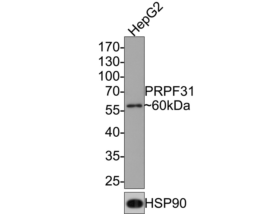 Western blot analysis of PRPF31 on HepG2 cell lysates with Rabbit anti-PRPF31 antibody (HA721089) at 1/500 dilution.<br />
<br />
Lysates/proteins at 10 µg/Lane.<br />
<br />
Predicted band size: 55 kDa<br />
Observed band size: 60 kDa<br />
<br />
Exposure time: 2 minutes;<br />
<br />
10% SDS-PAGE gel.<br />
<br />
Proteins were transferred to a PVDF membrane and blocked with 5% NFDM/TBST for 1 hour at room temperature. The primary antibody (HA721089) at 1/500 dilution was used in 5% NFDM/TBST at room temperature for 2 hours. Goat Anti-Rabbit IgG - HRP Secondary Antibody (HA1001) at 1:300,000 dilution was used for 1 hour at room temperature.