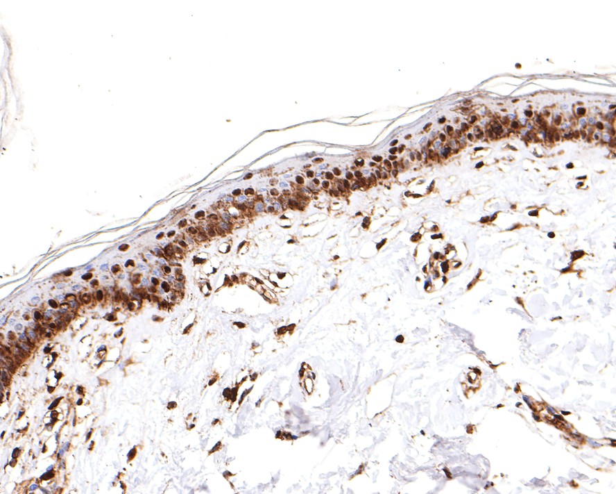 Immunohistochemical analysis of paraffin-embedded human skin tissue with Rabbit anti-PRPF31 antibody (HA721089) at 1/200 dilution.<br />
<br />
The section was pre-treated using heat mediated antigen retrieval with sodium citrate buffer (pH 6.0) for 2 minutes. The tissues were blocked in 1% BSA for 20 minutes at room temperature, washed with ddH2O and PBS, and then probed with the primary antibody (HA721089) at 1/200 dilution for 1 hour at room temperature. The detection was performed using an HRP conjugated compact polymer system. DAB was used as the chromogen. Tissues were counterstained with hematoxylin and mounted with DPX.
