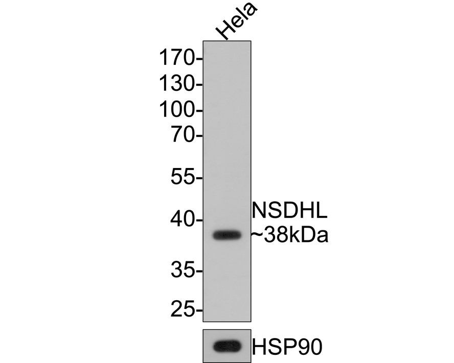 Western blot analysis of NSDHL on Hela cell lysates with Rabbit anti-NSDHL antibody (HA721088) at 1/5,000 dilution.<br />
<br />
Lysates/proteins at 10 µg/Lane.<br />
<br />
Predicted band size: 42 kDa<br />
Observed band size: 38 kDa<br />
<br />
Exposure time: 1 minute;<br />
<br />
10% SDS-PAGE gel.<br />
<br />
Proteins were transferred to a PVDF membrane and blocked with 5% NFDM/TBST for 1 hour at room temperature. The primary antibody (HA721088) at 1/5,000 dilution was used in 5% NFDM/TBST at room temperature for 2 hours. Goat Anti-Rabbit IgG - HRP Secondary Antibody (HA1001) at 1:300,000 dilution was used for 1 hour at room temperature.