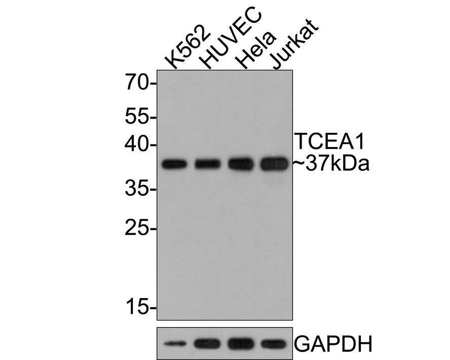 Western blot analysis of TCEA1 on different lysates with Rabbit anti-TCEA1 antibody (HA721086) at 1/500 dilution.<br />
<br />
Lane 1: K562 cell lysate<br />
Lane 2: HUVEC cell lysate<br />
Lane 3: Hela cell lysate<br />
Lane 4: Jurkat cell lysate<br />
<br />
Lysates/proteins at 10 µg/Lane.<br />
<br />
Predicted band size: 34 kDa<br />
Observed band size: 37 kDa<br />
<br />
Exposure time: 1 minute;<br />
<br />
12% SDS-PAGE gel.<br />
<br />
Proteins were transferred to a PVDF membrane and blocked with 5% NFDM/TBST for 1 hour at room temperature. The primary antibody (HA721086) at 1/500 dilution was used in 5% NFDM/TBST at room temperature for 2 hours. Goat Anti-Rabbit IgG - HRP Secondary Antibody (HA1001) at 1:300,000 dilution was used for 1 hour at room temperature.