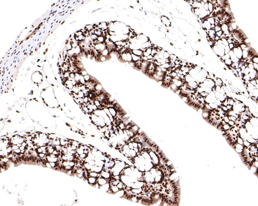 Immunohistochemical analysis of paraffin-embedded mouse large intestine tissue with Rabbit anti-TCEA1 antibody (HA721086) at 1/400 dilution.<br />
<br />
The section was pre-treated using heat mediated antigen retrieval with sodium citrate buffer (pH 6.0) for 2 minutes. The tissues were blocked in 1% BSA for 20 minutes at room temperature, washed with ddH2O and PBS, and then probed with the primary antibody (HA721086) at 1/400 dilution for 1 hour at room temperature. The detection was performed using an HRP conjugated compact polymer system. DAB was used as the chromogen. Tissues were counterstained with hematoxylin and mounted with DPX.