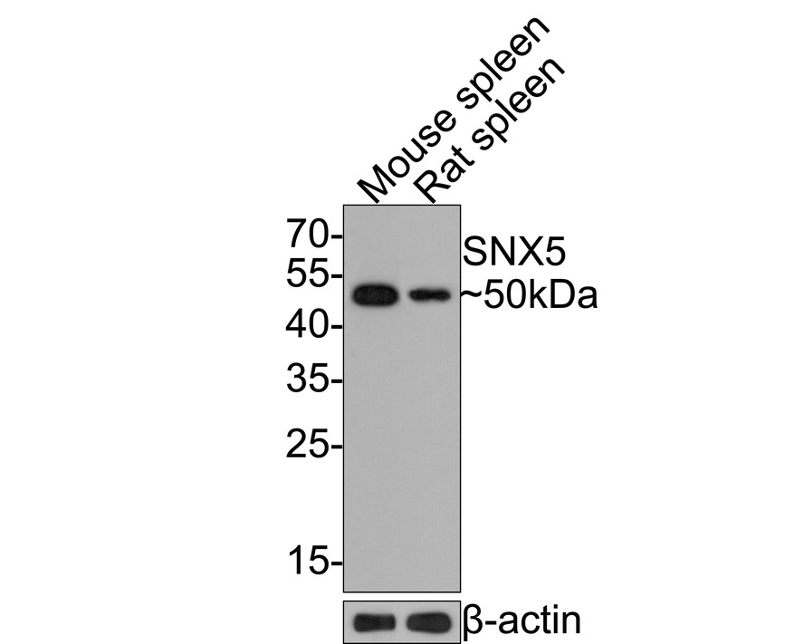 Western blot analysis of SNX5 on different lysates with Rabbit anti-SNX5 antibody (HA721084) at 1/500 dilution.<br />
<br />
Lane 1: Mouse spleen tissue lysate<br />
Lane 2: Rat spleen tissue lysate<br />
<br />
Lysates/proteins at 20 µg/Lane.<br />
<br />
Predicted band size: 47 kDa<br />
Observed band size: 50 kDa<br />
<br />
Exposure time: 2 minutes;<br />
<br />
12% SDS-PAGE gel.<br />
<br />
Proteins were transferred to a PVDF membrane and blocked with 5% NFDM/TBST for 1 hour at room temperature. The primary antibody (HA721084) at 1/500 dilution was used in 5% NFDM/TBST at room temperature for 2 hours. Goat Anti-Rabbit IgG - HRP Secondary Antibody (HA1001) at 1:300,000 dilution was used for 1 hour at room temperature.