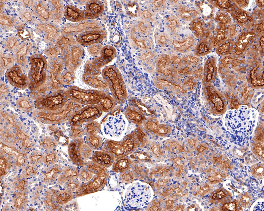 Immunohistochemical analysis of paraffin-embedded mouse kidney tissue with Rabbit anti-SNX5 antibody (HA721084) at 1/400 dilution.<br />
<br />
The section was pre-treated using heat mediated antigen retrieval with Tris-EDTA buffer (pH 9.0) for 20 minutes. The tissues were blocked in 1% BSA for 20 minutes at room temperature, washed with ddH2O and PBS, and then probed with the primary antibody (HA721084) at 1/400 dilution for 1 hour at room temperature. The detection was performed using an HRP conjugated compact polymer system. DAB was used as the chromogen. Tissues were counterstained with hematoxylin and mounted with DPX.