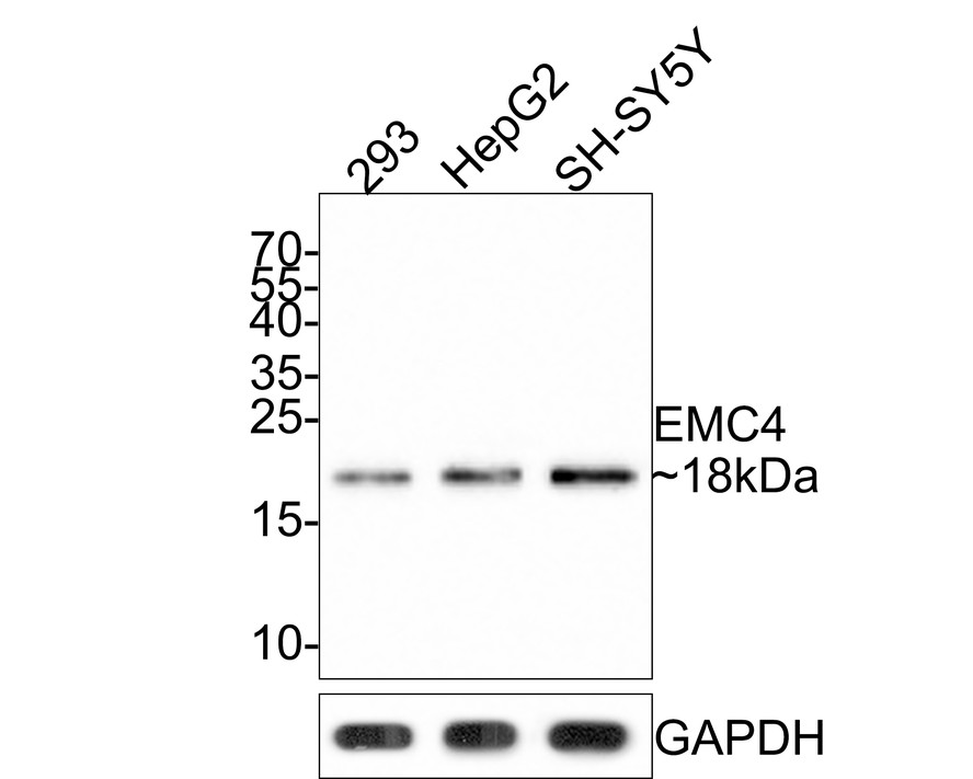 Western blot analysis of EMC4 on different lysates with Rabbit anti-EMC4 antibody (HA721082) at 1/500 dilution.<br />
<br />
Lane 1: 293 cell lysate<br />
Lane 2: HepG2 cell lysate<br />
Lane 3: SH-SY5Y cell lysate<br />
<br />
Lysates/proteins at 10 µg/Lane.<br />
<br />
Predicted band size: 20 kDa<br />
Observed band size: 18 kDa<br />
<br />
Exposure time: 2 minutes;<br />
<br />
15% SDS-PAGE gel.<br />
<br />
Proteins were transferred to a PVDF membrane and blocked with 5% NFDM/TBST for 1 hour at room temperature. The primary antibody (HA721082) at 1/500 dilution was used in 5% NFDM/TBST at room temperature for 2 hours. Goat Anti-Rabbit IgG - HRP Secondary Antibody (HA1001) at 1:300,000 dilution was used for 1 hour at room temperature.