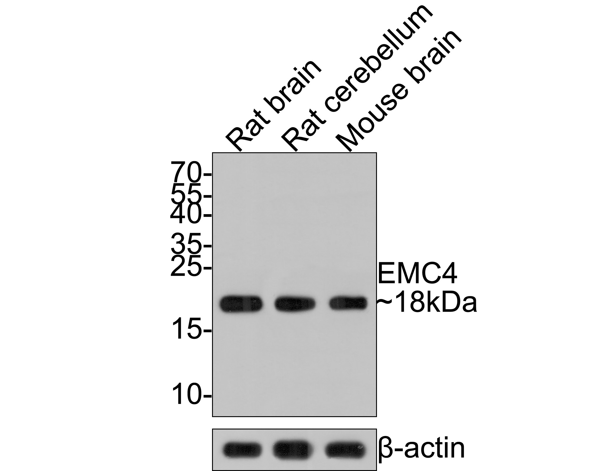Western blot analysis of EMC4 on different lysates with Rabbit anti-EMC4 antibody (HA721082) at 1/500 dilution.<br />
<br />
Lane 1: Rat brain tissue lysate<br />
Lane 2: Rat cerebellum tissue lysate<br />
Lane 3: Mouse brain tissue lysate<br />
<br />
Lysates/proteins at 20 µg/Lane.<br />
<br />
Predicted band size: 20 kDa<br />
Observed band size: 18 kDa<br />
<br />
Exposure time: 1 minute;<br />
<br />
15% SDS-PAGE gel.<br />
<br />
Proteins were transferred to a PVDF membrane and blocked with 5% NFDM/TBST for 1 hour at room temperature. The primary antibody (HA721082) at 1/500 dilution was used in 5% NFDM/TBST at room temperature for 2 hours. Goat Anti-Rabbit IgG - HRP Secondary Antibody (HA1001) at 1:300,000 dilution was used for 1 hour at room temperature.