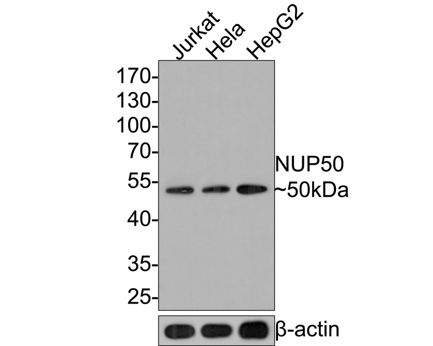 Western blot analysis of NUP50 on different lysates with Rabbit anti-NUP50 antibody (HA721075) at 1/500 dilution.<br />
<br />
Lane 1: Jurkat cell lysate<br />
Lane 2: Hela cell lysate<br />
Lane 3: HepG2 cell lysate<br />
<br />
Lysates/proteins at 10 µg/Lane.<br />
<br />
Predicted band size: 50 kDa<br />
Observed band size: 50 kDa<br />
<br />
Exposure time: 2 minutes;<br />
<br />
10% SDS-PAGE gel.<br />
<br />
Proteins were transferred to a PVDF membrane and blocked with 5% NFDM/TBST for 1 hour at room temperature. The primary antibody (HA721075) at 1/500 dilution was used in 5% NFDM/TBST at room temperature for 2 hours. Goat Anti-Rabbit IgG - HRP Secondary Antibody (HA1001) at 1:300,000 dilution was used for 1 hour at room temperature.