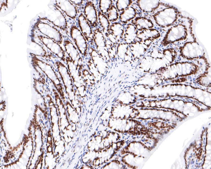 Immunohistochemical analysis of paraffin-embedded rat large intestine tissue with Rabbit anti-NUP50 antibody (HA721075) at 1/400 dilution.<br />
<br />
The section was pre-treated using heat mediated antigen retrieval with sodium citrate buffer (pH 6.0) for 2 minutes. The tissues were blocked in 1% BSA for 20 minutes at room temperature, washed with ddH2O and PBS, and then probed with the primary antibody (HA721075) at 1/400 dilution for 1 hour at room temperature. The detection was performed using an HRP conjugated compact polymer system. DAB was used as the chromogen. Tissues were counterstained with hematoxylin and mounted with DPX.