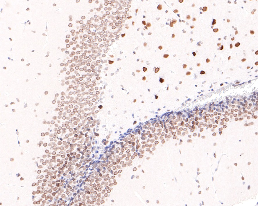 Immunohistochemical analysis of paraffin-embedded mouse hippocampus tissue with Rabbit anti-NUP50 antibody (HA721075) at 1/400 dilution.<br />
<br />
The section was pre-treated using heat mediated antigen retrieval with sodium citrate buffer (pH 6.0) for 2 minutes. The tissues were blocked in 1% BSA for 20 minutes at room temperature, washed with ddH2O and PBS, and then probed with the primary antibody (HA721075) at 1/400 dilution for 1 hour at room temperature. The detection was performed using an HRP conjugated compact polymer system. DAB was used as the chromogen. Tissues were counterstained with hematoxylin and mounted with DPX.