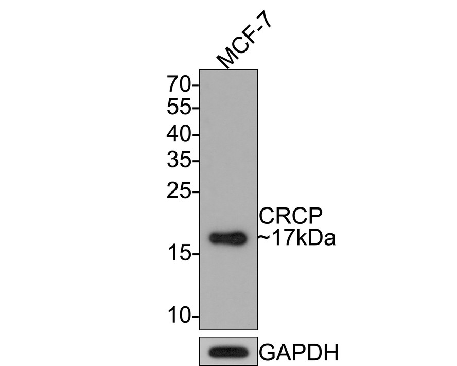 Western blot analysis of CRCP on MCF-7 cell lysates with Rabbit anti-CRCP antibody (HA721062) at 1/500 dilution.<br />
<br />
Lysates/proteins at 10 µg/Lane.<br />
<br />
Predicted band size: 17 kDa<br />
Observed band size: 17 kDa<br />
<br />
Exposure time: 2 minutes;<br />
<br />
15% SDS-PAGE gel.<br />
<br />
Proteins were transferred to a PVDF membrane and blocked with 5% NFDM/TBST for 1 hour at room temperature. The primary antibody (HA721062) at 1/500 dilution was used in 5% NFDM/TBST at room temperature for 2 hours. Goat Anti-Rabbit IgG - HRP Secondary Antibody (HA1001) at 1:300,000 dilution was used for 1 hour at room temperature.