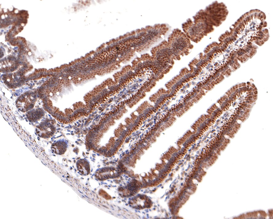 Immunohistochemical analysis of paraffin-embedded mouse small intestine tissue with Rabbit anti-CRCP antibody (HA721062) at 1/100 dilution.<br />
<br />
The section was pre-treated using heat mediated antigen retrieval with sodium citrate buffer (pH 6.0) for 2 minutes. The tissues were blocked in 1% BSA for 20 minutes at room temperature, washed with ddH2O and PBS, and then probed with the primary antibody (HA721062) at 1/100 dilution for 1 hour at room temperature. The detection was performed using an HRP conjugated compact polymer system. DAB was used as the chromogen. Tissues were counterstained with hematoxylin and mounted with DPX.