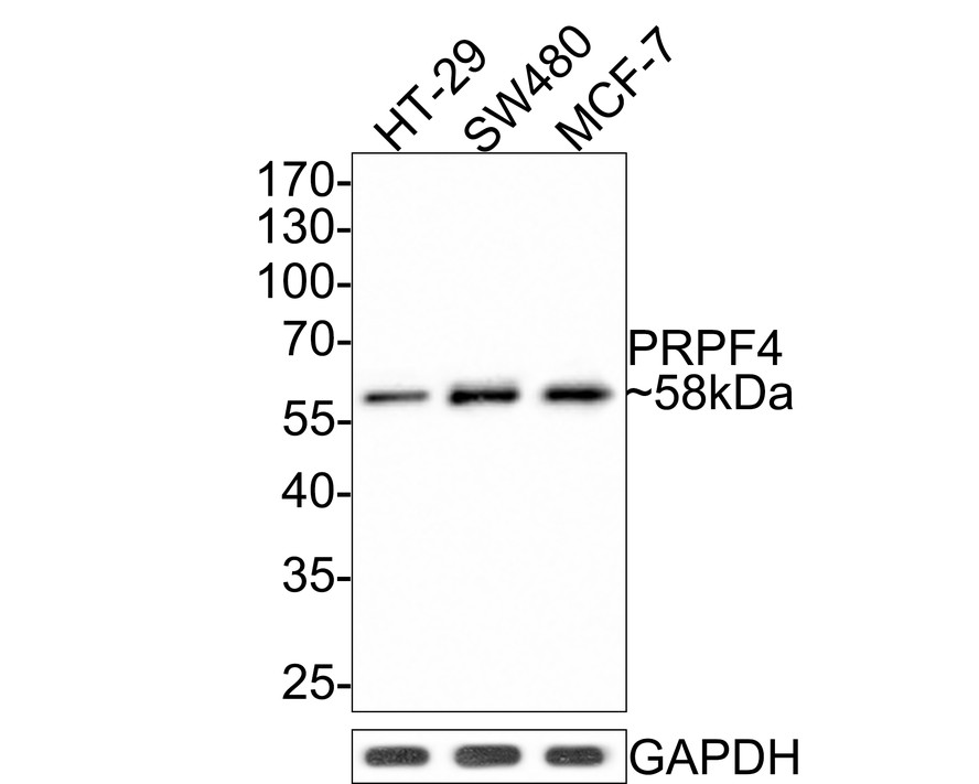 Western blot analysis of PRPF4 on different lysates with Rabbit anti-PRPF4 antibody (HA721063) at 1/500 dilution.<br />
<br />
Lane 1: HT-29 cell lysate<br />
Lane 2: SW480 cell lysate<br />
Lane 3: MCF-7 cell lysate<br />
<br />
Lysates/proteins at 10 µg/Lane.<br />
<br />
Predicted band size: 58 kDa<br />
Observed band size: 58 kDa<br />
<br />
Exposure time: 2 minutes;<br />
<br />
10% SDS-PAGE gel.<br />
<br />
Proteins were transferred to a PVDF membrane and blocked with 5% NFDM/TBST for 1 hour at room temperature. The primary antibody (HA721063) at 1/500 dilution was used in 5% NFDM/TBST at room temperature for 2 hours. Goat Anti-Rabbit IgG - HRP Secondary Antibody (HA1001) at 1:300,000 dilution was used for 1 hour at room temperature.