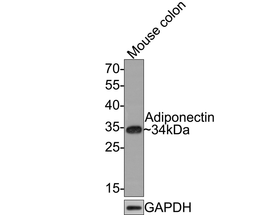 Western blot analysis of Adiponectin on mouse colon tissue lysates with Rabbit anti-Adiponectin antibody (HA721064) at 1/500 dilution.<br />
<br />
Lysates/proteins at 20 µg/Lane.<br />
<br />
Predicted band size: 27 kDa<br />
Observed band size: 34 kDa<br />
<br />
Exposure time: 2 minutes;<br />
<br />
12% SDS-PAGE gel.<br />
<br />
Proteins were transferred to a PVDF membrane and blocked with 5% NFDM/TBST for 1 hour at room temperature. The primary antibody (HA721064) at 1/500 dilution was used in 5% NFDM/TBST at room temperature for 2 hours. Goat Anti-Rabbit IgG - HRP Secondary Antibody (HA1001) at 1:300,000 dilution was used for 1 hour at room temperature.